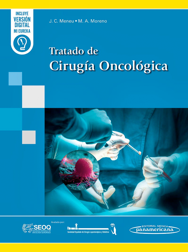 Tratado de cirugía oncológica