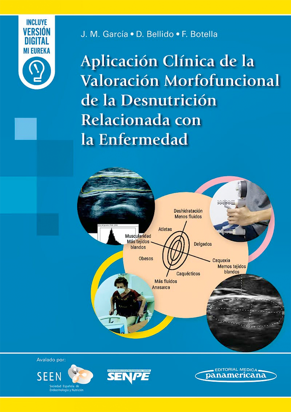 Aplicación clínica de la valoración morfofuncional de la desnutrición relacionada con la enfermedad