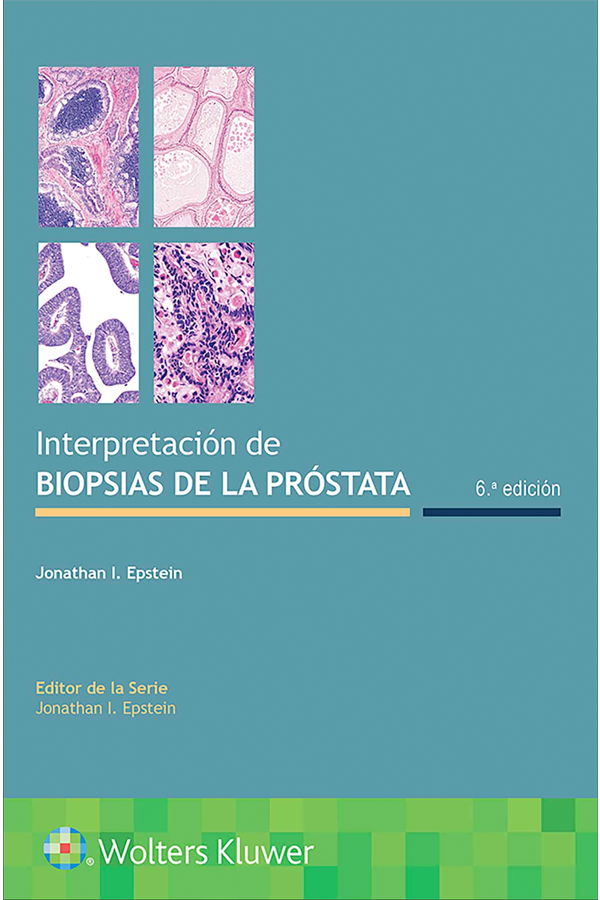 Interpretación de biopsias de la próstata 6ª Ed.