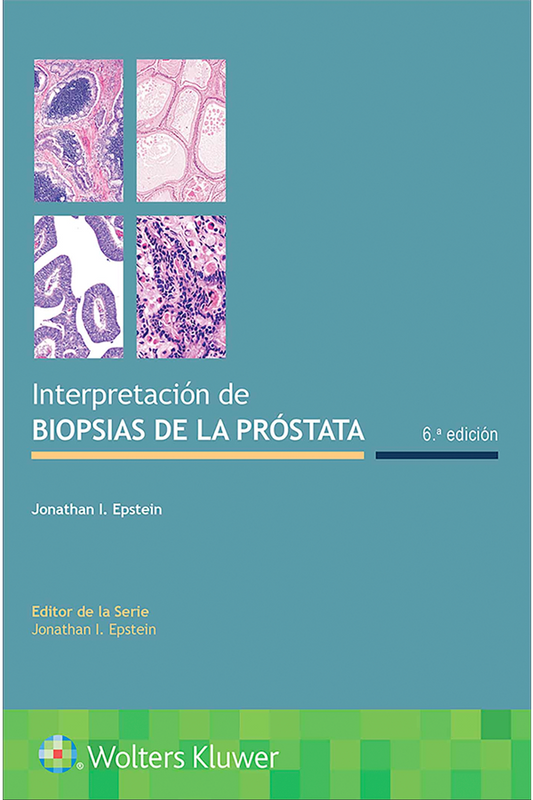 Interpretación de biopsias de la próstata 6ª Ed.