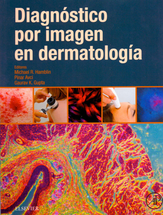 Diagnóstico por imagen en dermatología