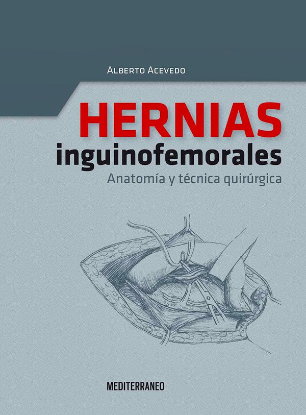 Hernias inguinofemorales. Anatomía y técnica quirúrgica