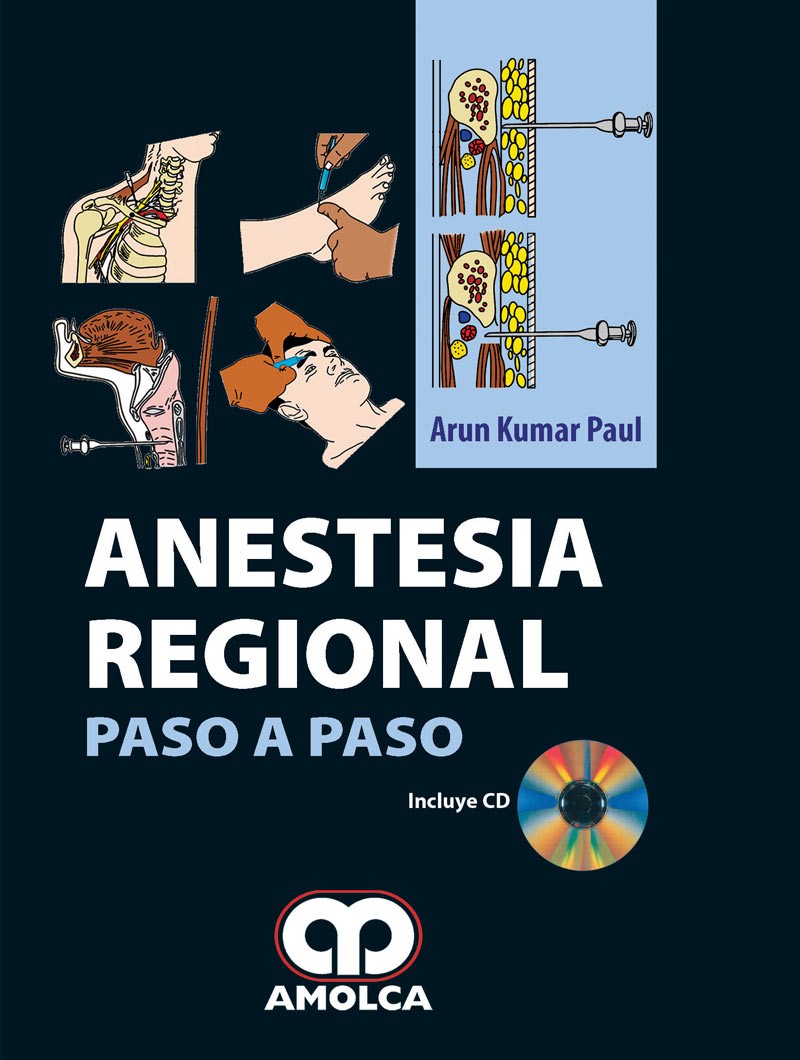 Anestesia Regional Paso A...