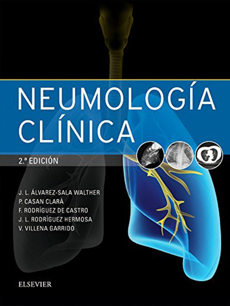 Neumología Clínica 2° Ed.