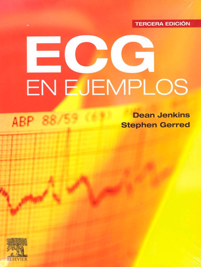 ECG en Ejemplos 3° Ed