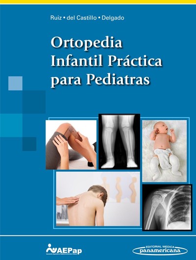 Ortopedia Infantil Practica...