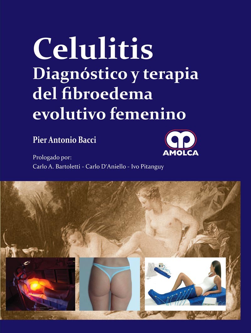 Celulitis Diagnóstico y...