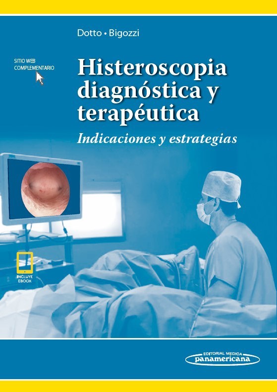 HISTEROSCOPIA DIAGNOSTICA Y...