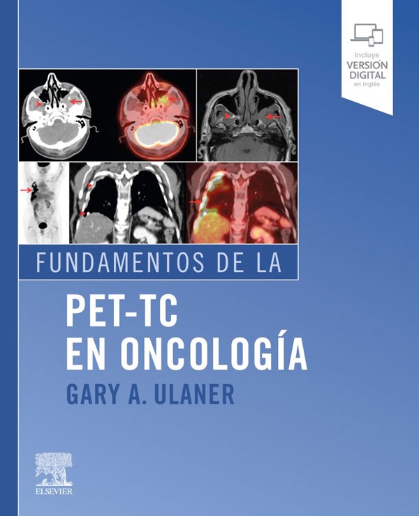 Fundamentos del PET-TC en...