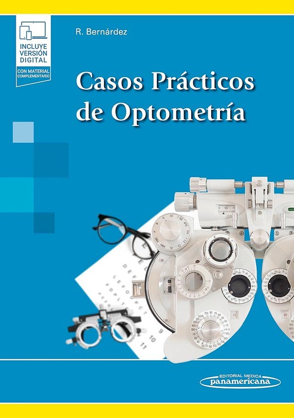 Casos prácticos de optometría