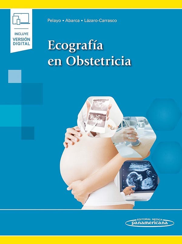 Ecografía en obstetricia