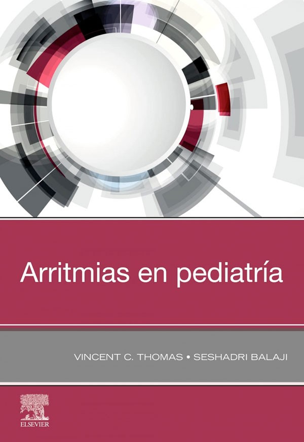 Arritmias en pediatría