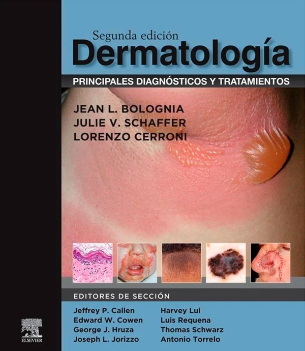 Dermatología. Principales...