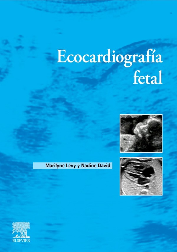 Ecocardiografía fetal