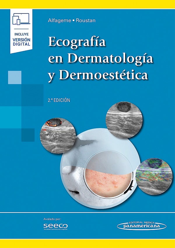 Ecografía en dermatología y...