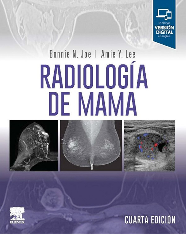 Radiología de mama 4ª Ed.