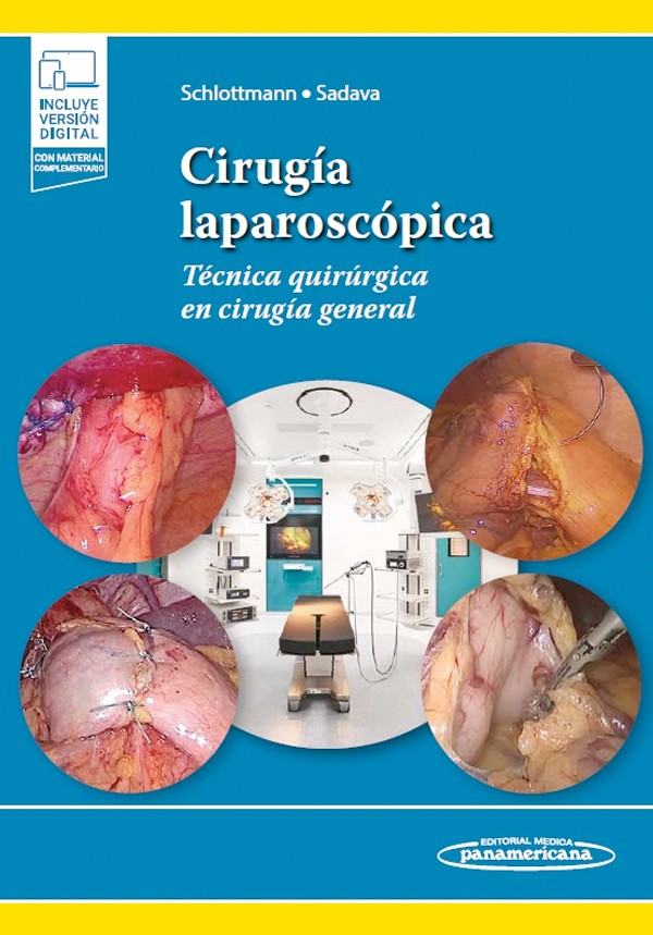Cirugía laparoscópica +...