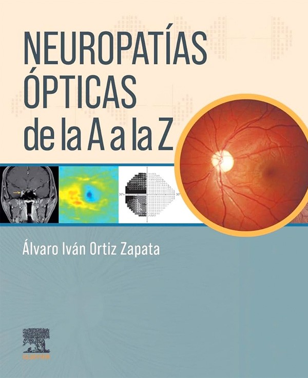 Neuropatías ópticas de la A...