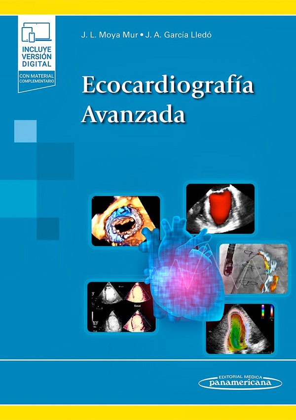 Ecocardiografía avanzada