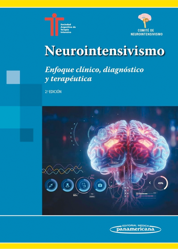 Neurointensiviso 2ª Ed.