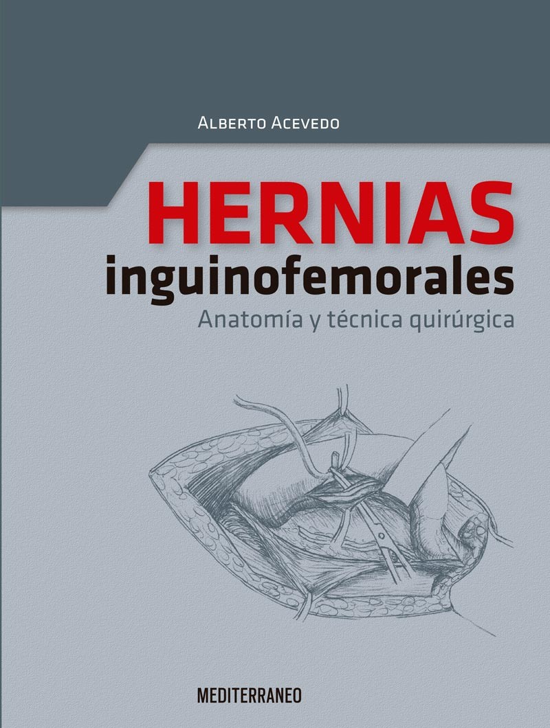 Hernias Inguinofemorales