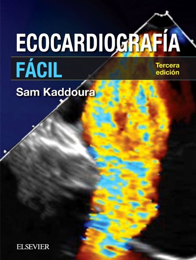 Ecocardiografía Fácil 3°Ed