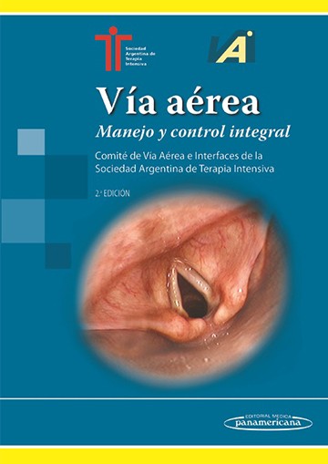 Vía Aérea, Manejo y Control Integral 2ª Ed.