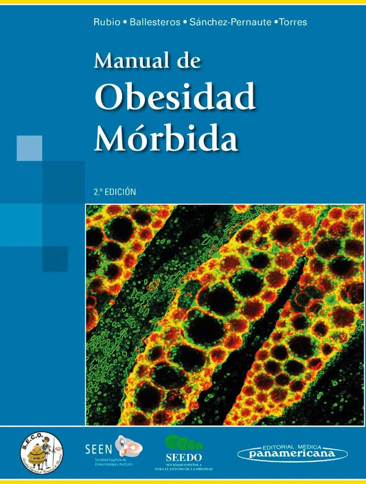 Manual de Obesidad Mórbida 2ª Ed.