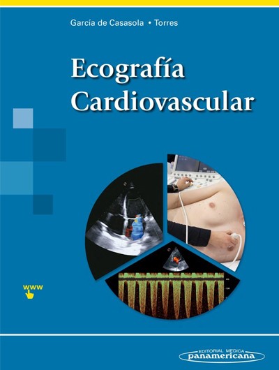 Ecografía Cardiovascular