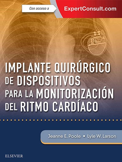 Implantes Quirúrgicos de Dispositivos Monitorización del Ritmo Cardíaco