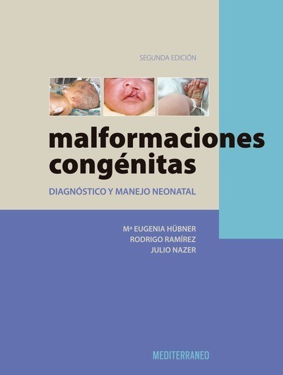 Malformaciones Congénitas 2ª Ed.