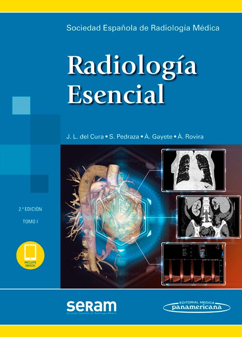 Radiología esencial 2ª Ed. [2 Tomos] + Ebook