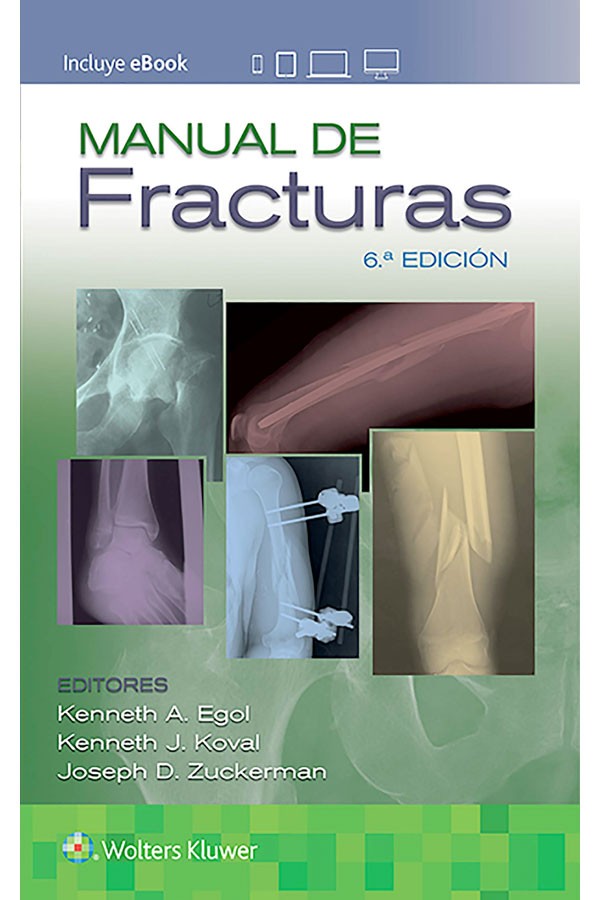 Manual de fracturas 6ª Ed.