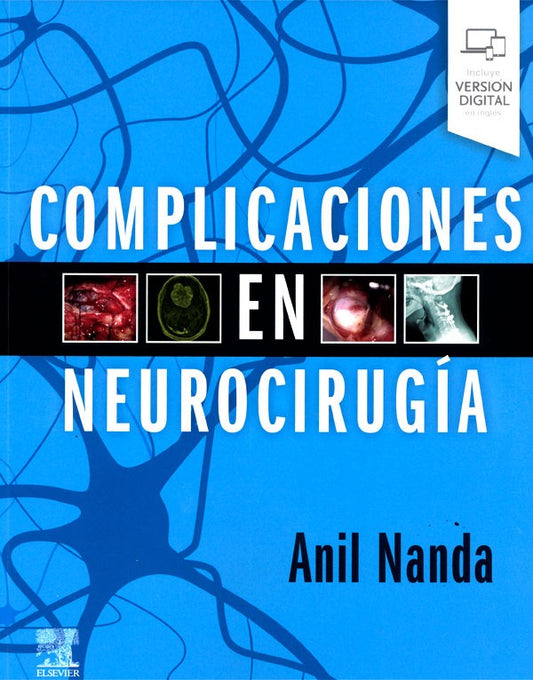 Complicaciones en neurocirugía