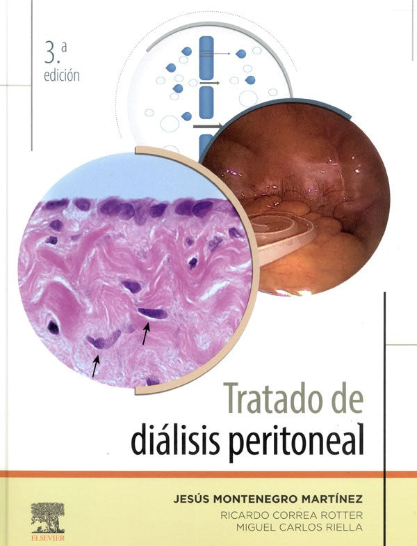 Tratado de diálisis peritoneal. 3ª Ed.