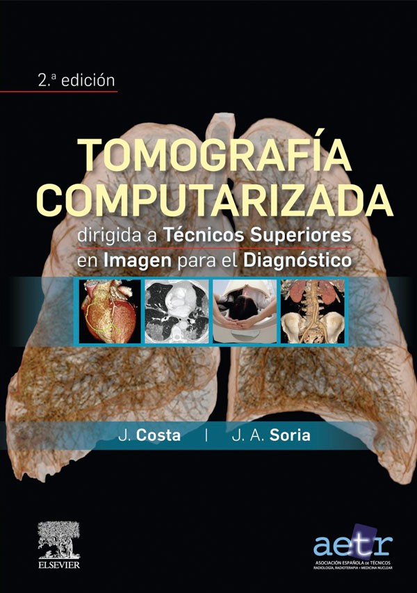 Tomografía computarizada para tecnicos superiores 2ª Ed.