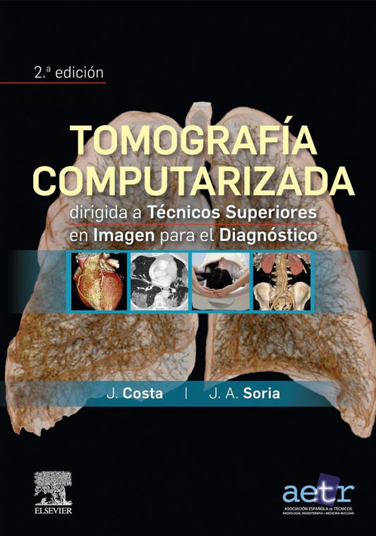 Tomografía computarizada para tecnicos superiores 2ª Ed.