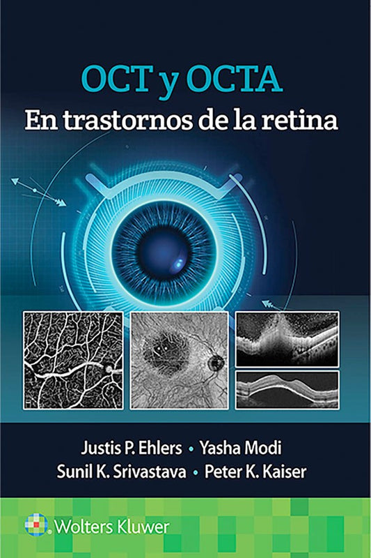 OCT y OCTA en trastornos de la retina