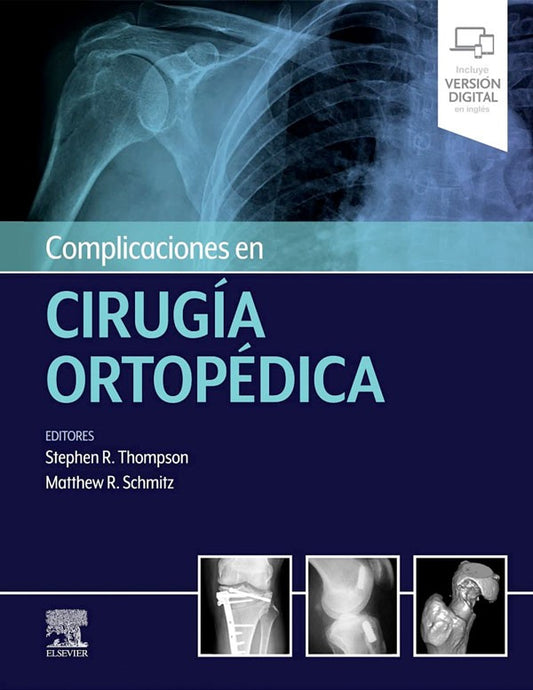 Complicaciones en cirugía ortopédica