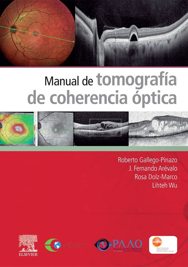 Manual de tomografía de coherencia óptica