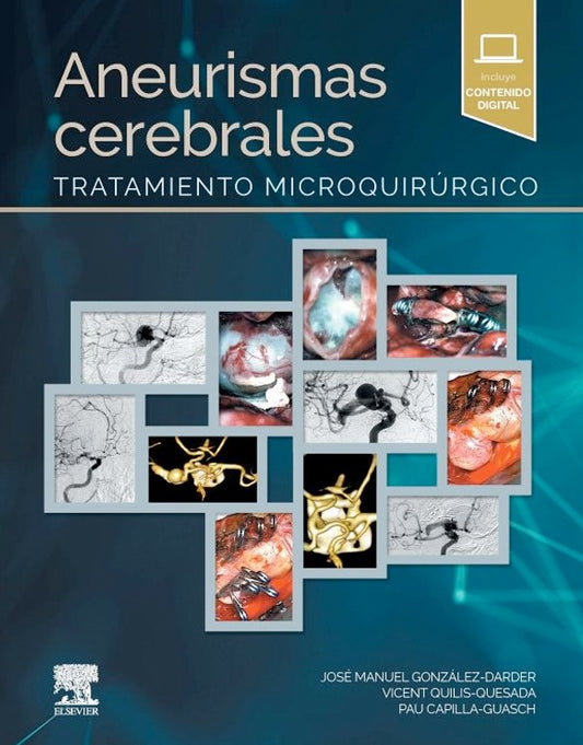 Aneurismas cerebrales. Tratamiento microquirurgico