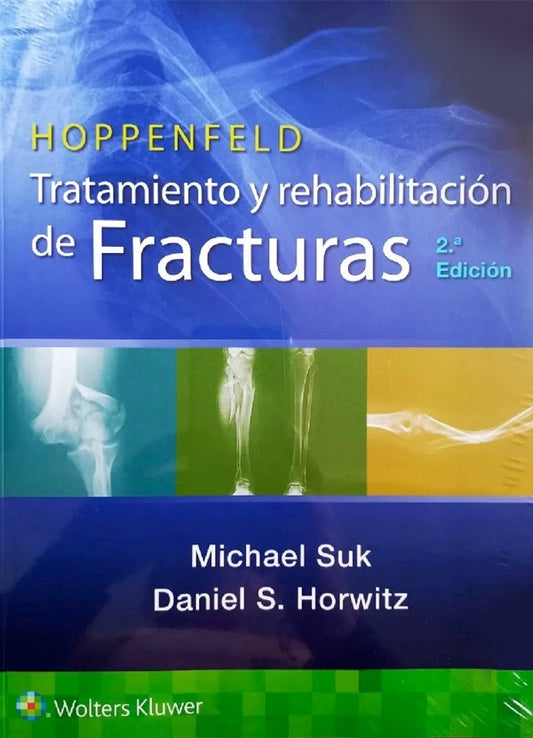 Hoppenfeld. Tratamiento y rehabilitación de fracturas 2ª Ed.