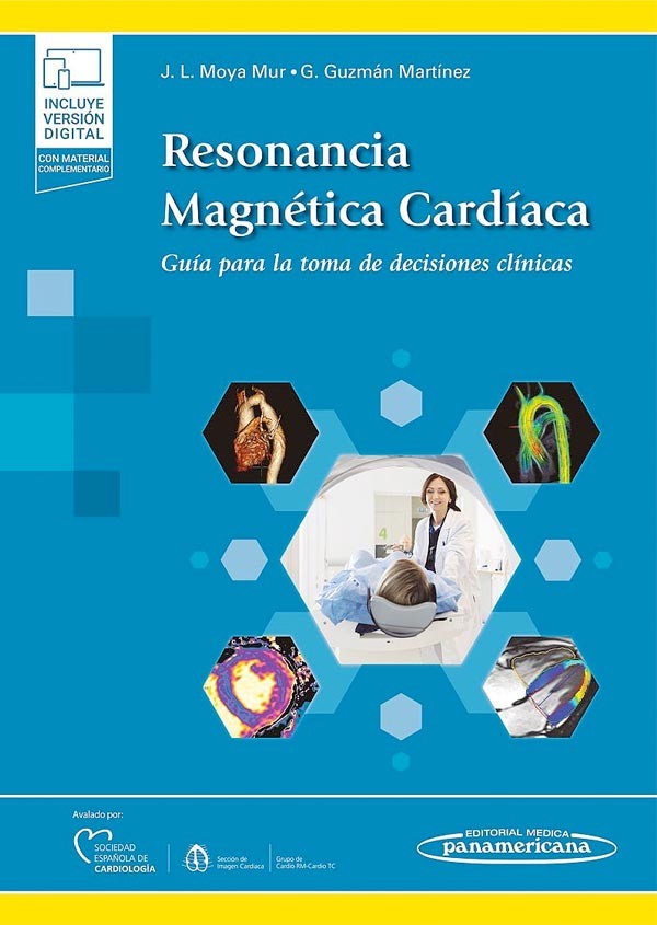 Resonancia magnetica cardiaca. Guía para la toma de decisisones