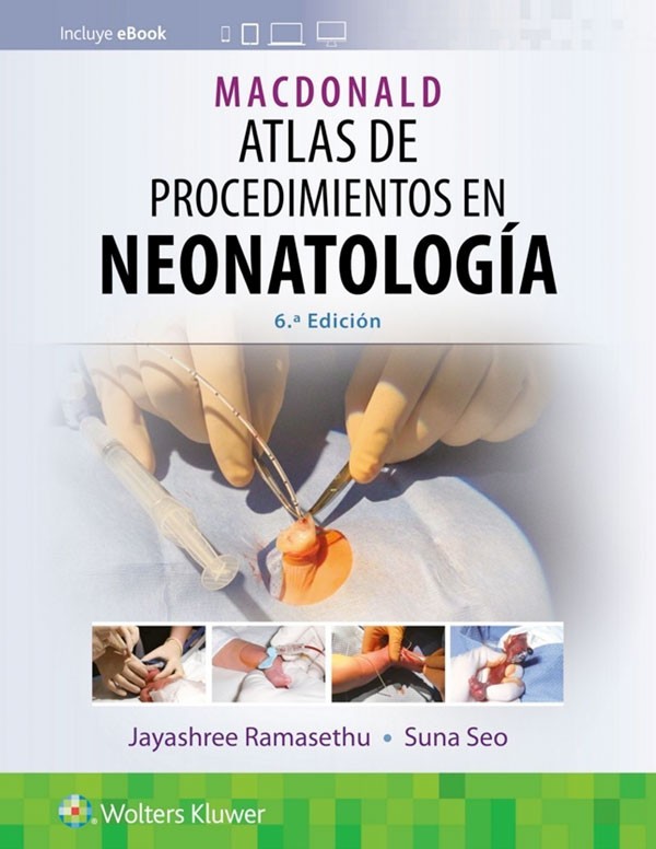 Macdonald. Atlas de procedimientos en neonatología 6ª Ed.