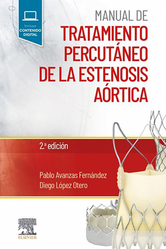 Manual de tratamiento percutáneo de la estenosis aórtica 2ª Ed.