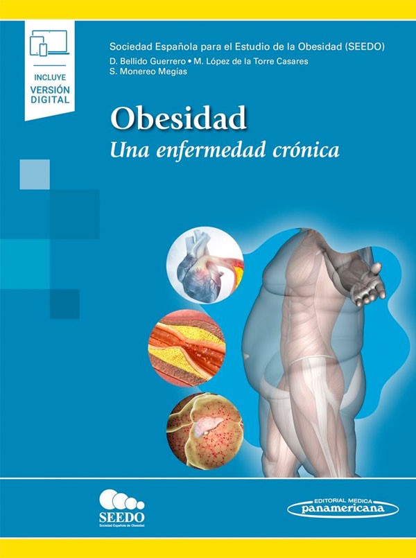 Obesidad una efermedad crónica