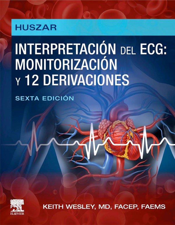 Interpretación del ECG: monitorización y 12 derivaciones 6ª Ed.