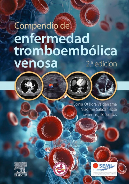 Compendio de enfermedad tromboembólica venosa 2ª Ed.