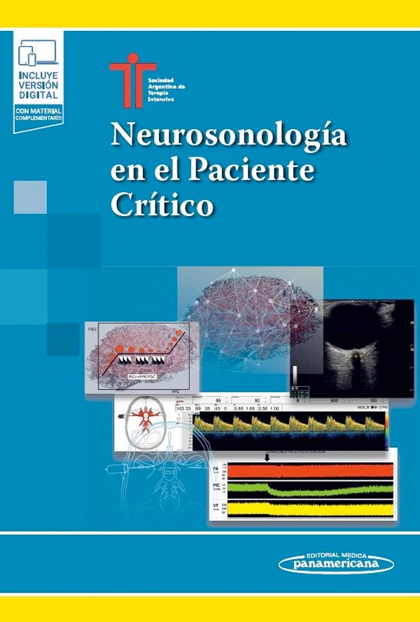 Neurosonología en el paciente crítico + Edición digital