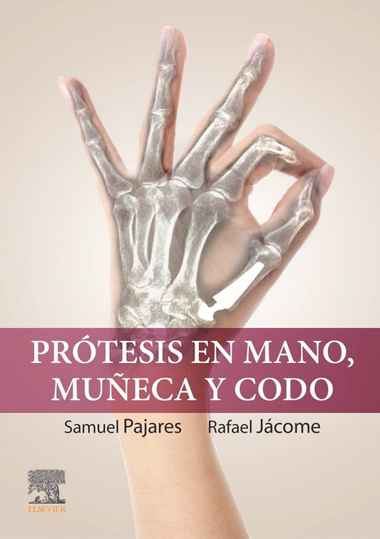 Prótesis en mano, muñeca y codo